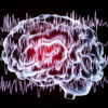 Epilepsy and Neurodiversity