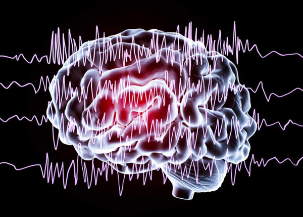 Epilepsy and Neurodiversity